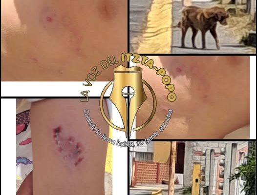 Denuncia ciudadana y advertencia vecinal: perro agresivo ataca a menor en Huejotzingo