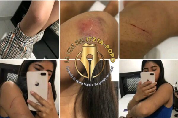 HUEJOTZINGO: DENUNCIA PÚBLICA POR REINCIDENCIA DE AGRESOR Y OMISIÓN DE AUTORIDADES